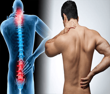 Backache or Back Pain